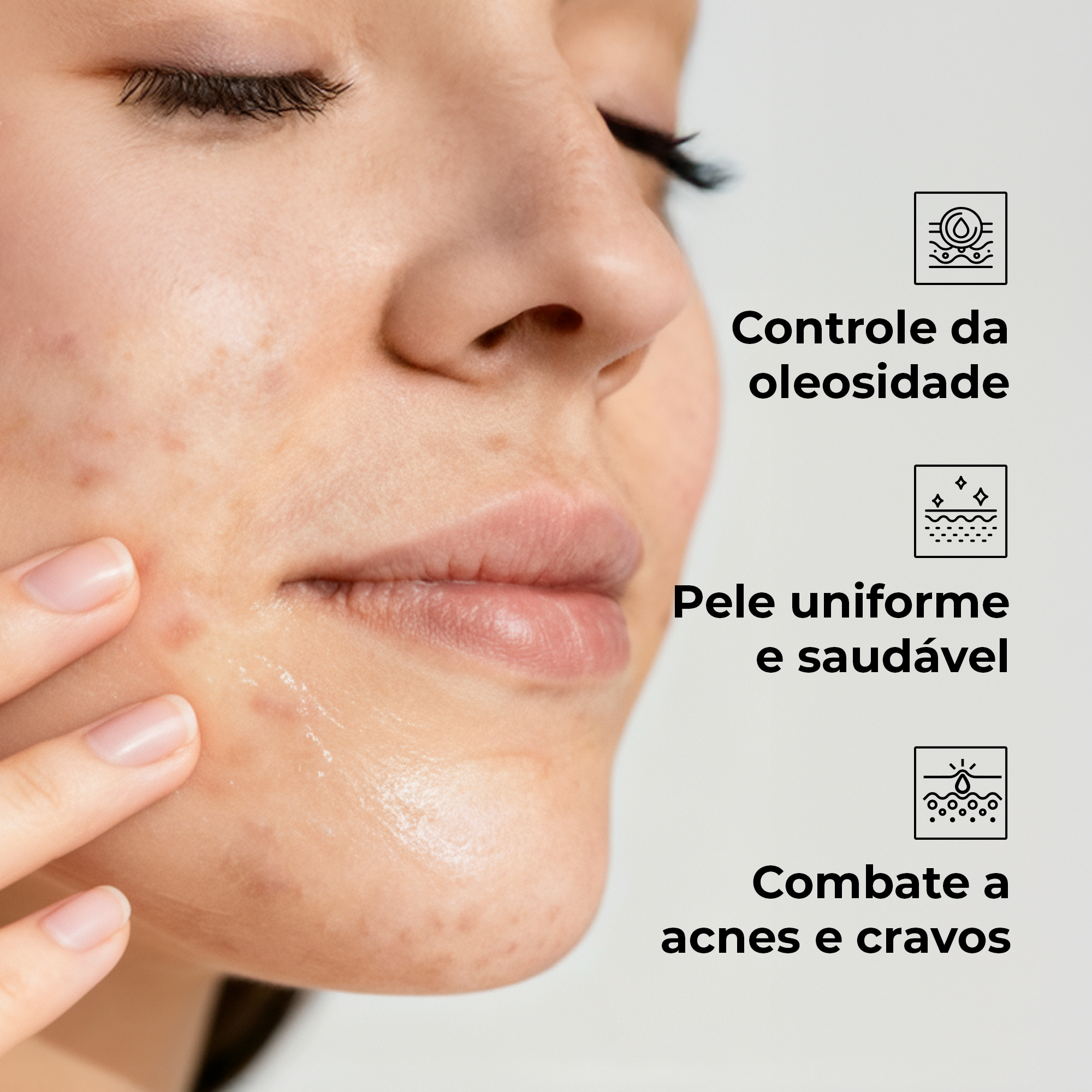 Sérum Facial Anti-Acne - 30ML